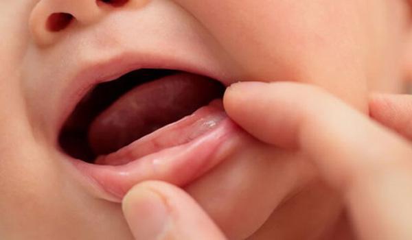 Trẻ mọc răng sớm có thể có ảnh hưởng đến phát triển ngôn ngữ của trẻ không?
